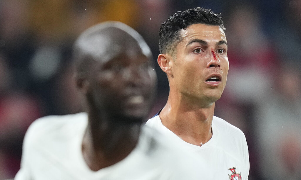 Ronaldo bị va chạm với thủ thành Tomas Vaclik 